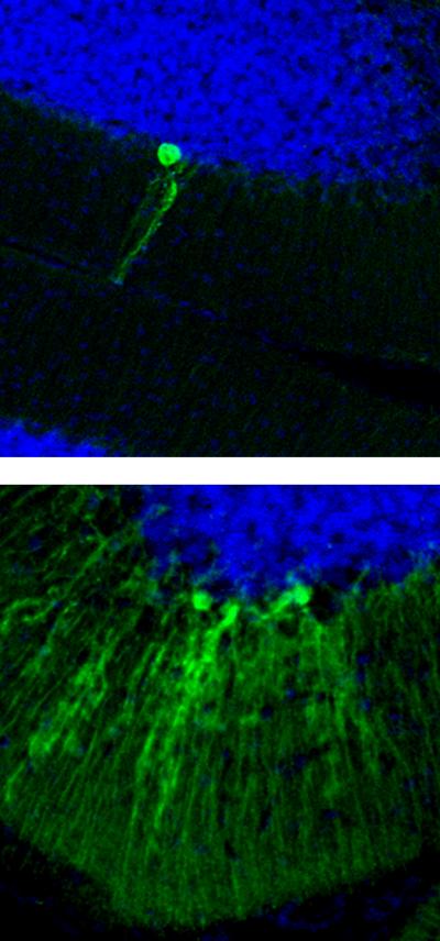 Rett Syndrome Mobilizes Jumping Genes in the Brain