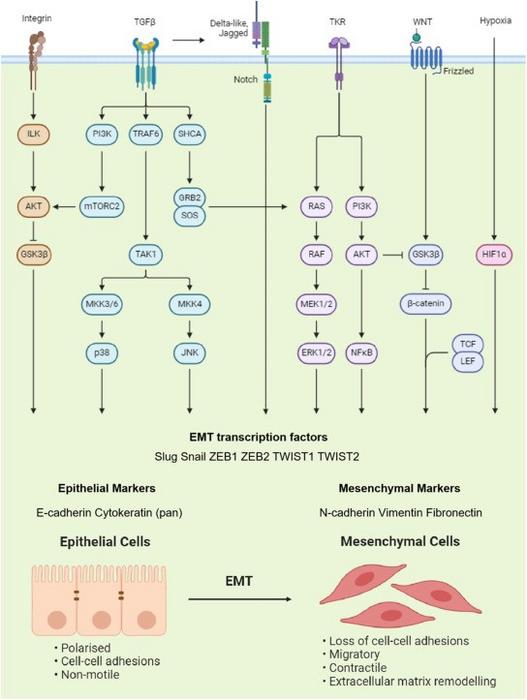 Epithelial–mesenchymal transition (EMT)-associated signaling pathways in glioblastoma
