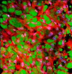 New Columbia Engineering Technique Converts White Fat to Brown Fat