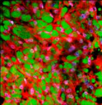New Columbia Engineering Technique Converts White Fat to Brown Fat