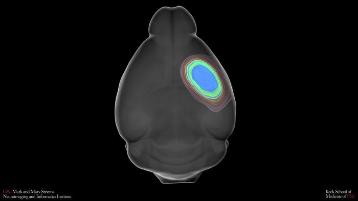 SPAN MRI scans