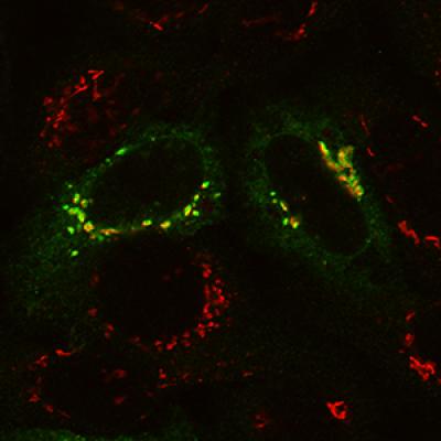 Surprising Culprit Found in Cell Recycling Defect -- Normal Cell