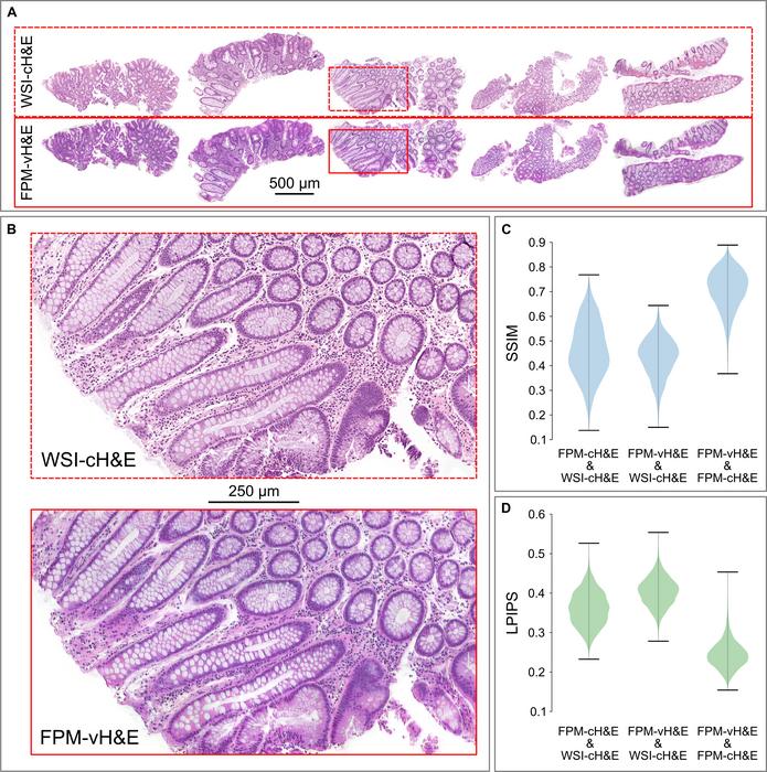 Comparison of WSI images of H&E-stained sections and VS-FPM images of unstained sections.
