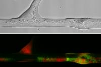 Bacteria
