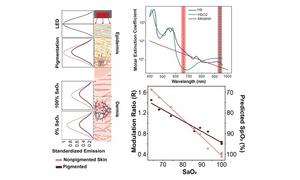 Research confirms that skin pigmentation can reduce the accuracy of pulse oximeters.