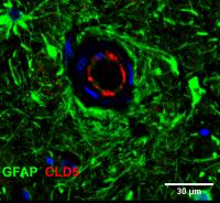 Glial fibrillary acidic protein (GFAP) and Claudin-5 Eurekalert