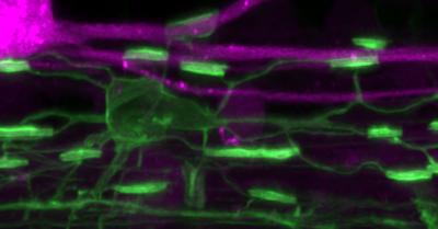 New Research Points to Potential Treatment Strategies for Multiple Sclerosis
