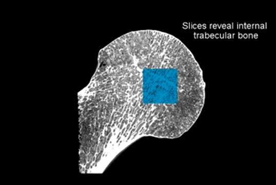 Femur Scan