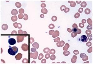 Blood Smear