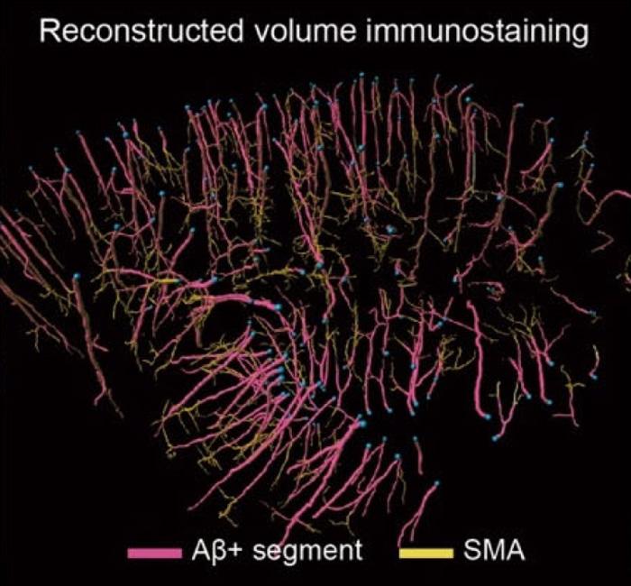 Reconstructed volume immunostaining