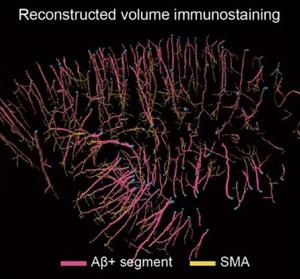 Reconstructed volume immunostaining