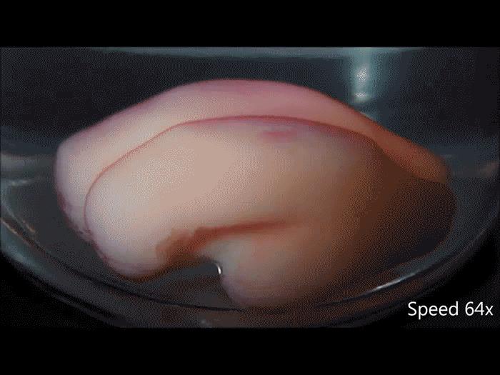Brain Folding