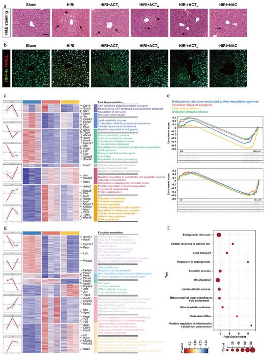 ACT alleviated liver damage in HIRI mice, and HR-stimulated hepatocytes.