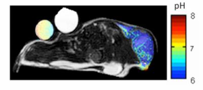 Tumor Cross Section