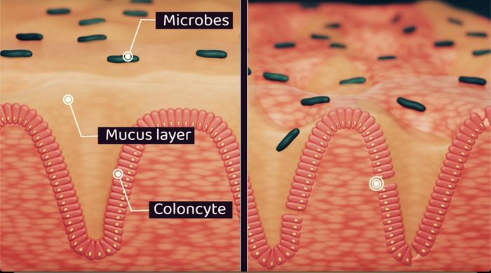 Image depicts a healthy versus unhealthy gut wall