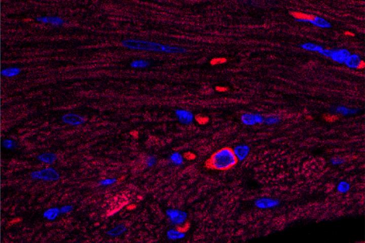 Scientists ID Source of Damaging Inflammation After Heart Attack