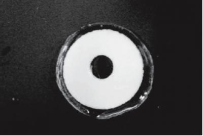 Contact Lens