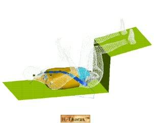 Seatbelt Pressure on Thorax