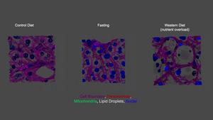 Comparative 3D visualization of hepatocyte organelle architecture in control, fasted, and Western diet–fed mice.