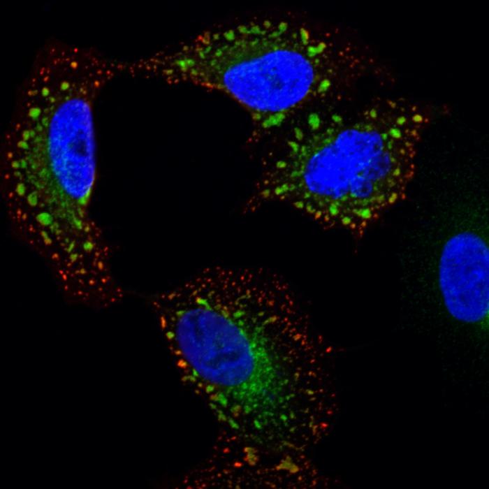 Human Lung Cell Infected With Influenza