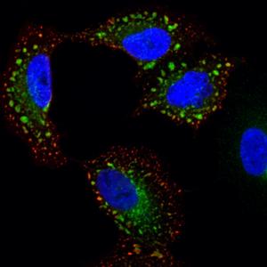 Human Lung Cell Infected With Influenza