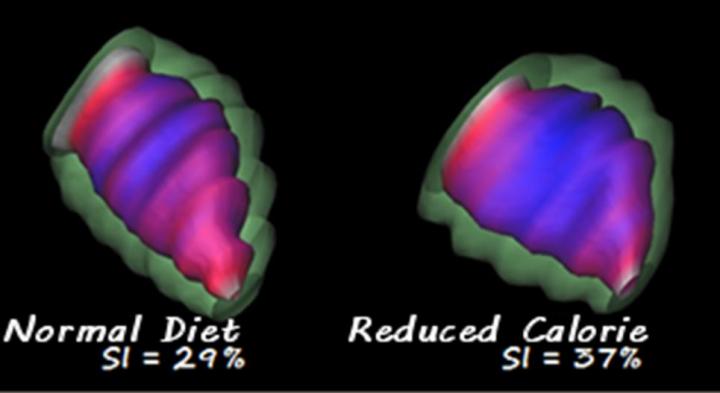 Undernourished Heart