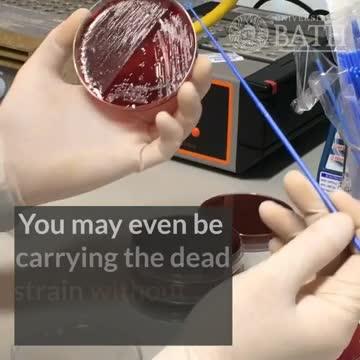 The Potentially Deadly Bacterium That's on Everyone's Skin