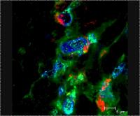 Interferon Beta in Leprosy