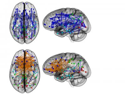 Sex Differences in Connectome of Human Brain
