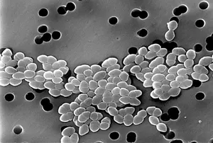 Vancomycin-Resistant_Enterococcus