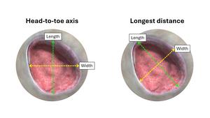 Wound measurements comparison
