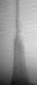 Muscle Fibers Contracting