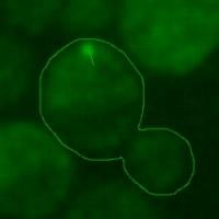 Aged Yeast Cell with Tracked Protein Aggregate