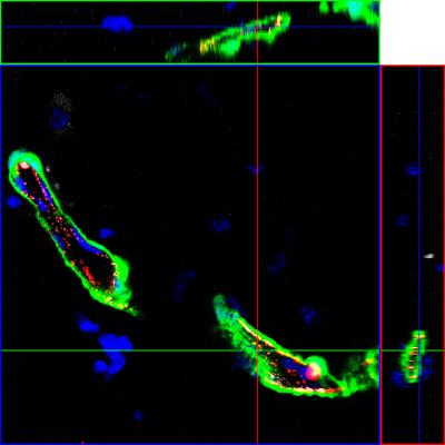 Functional Blood Vessels Grown in Vivo Form a Single Transplanted  Adult Vascular Endothelial Stem C