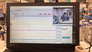 Lining up physiological measurements with video footage from the surgery