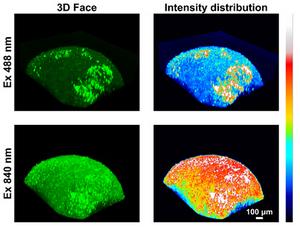 Two-photon imaging