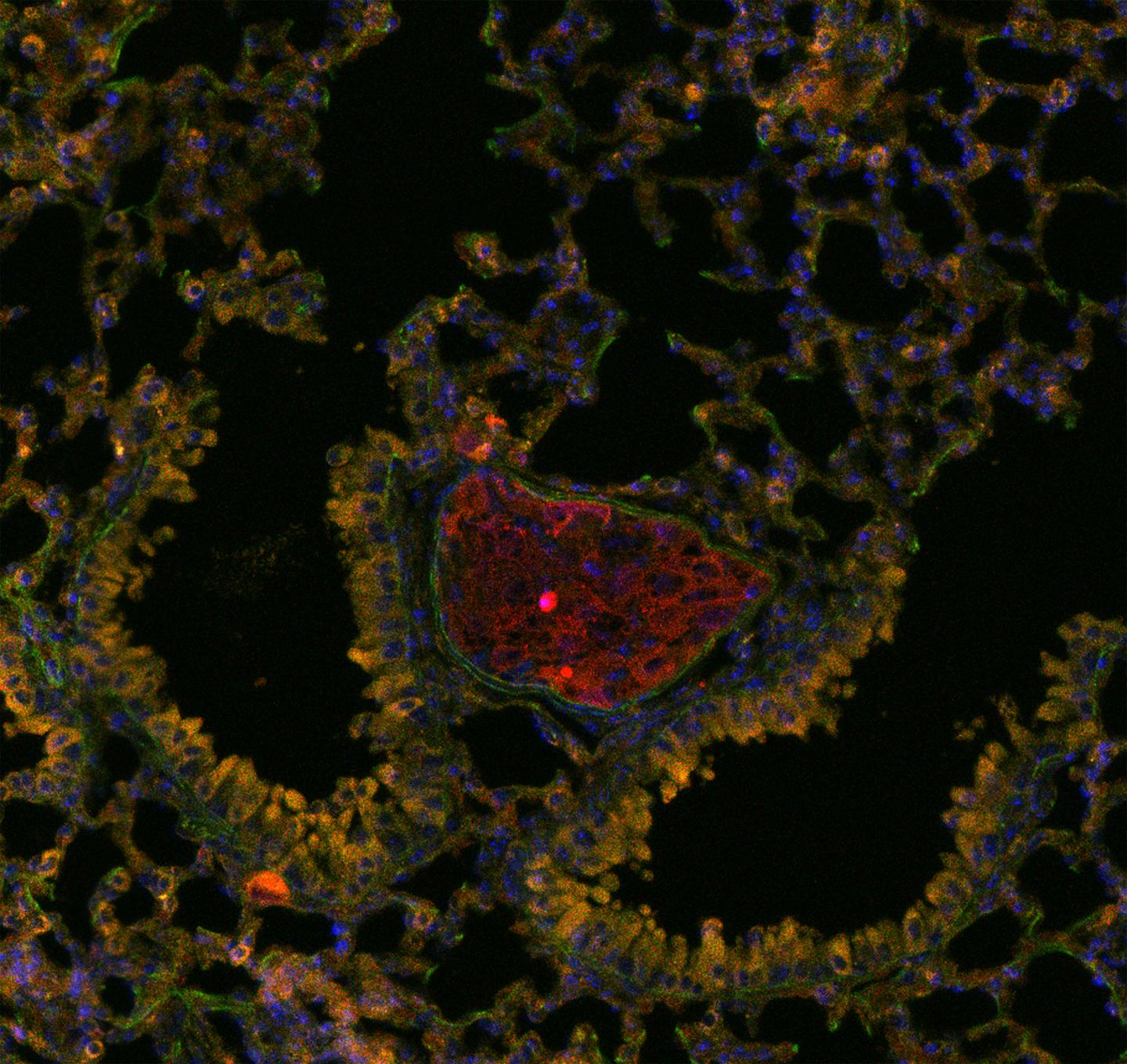 Nesting in Pre-Metastatic Niches