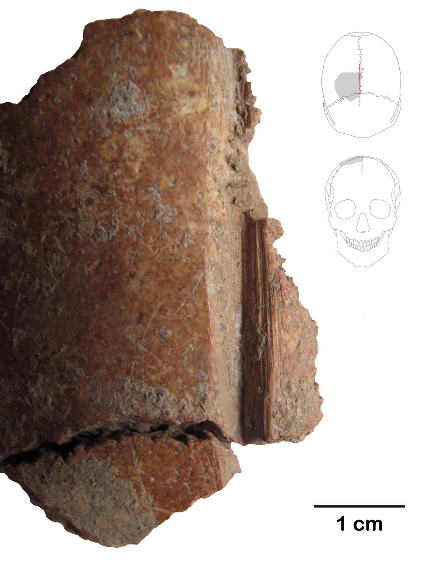 In Turkey, Carved Skulls Provide the First Evidence of a Neolithic "Skull Cult" (7 of 8)
