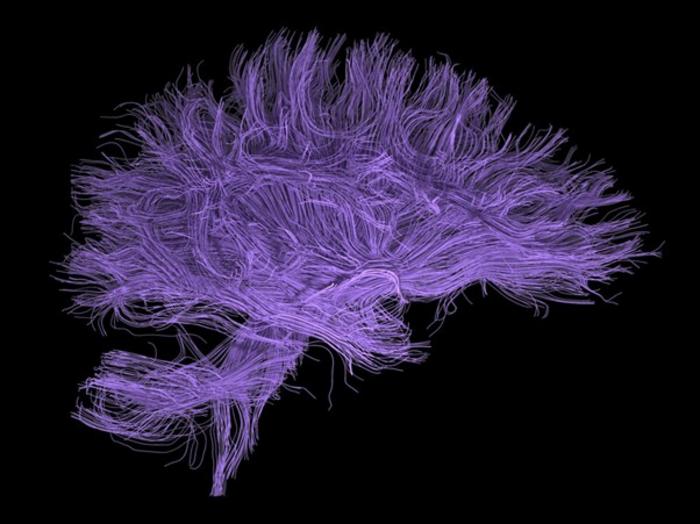 Brexpiprazole as an adjunct therapy for improving cognitive function in patients with schizophrenia