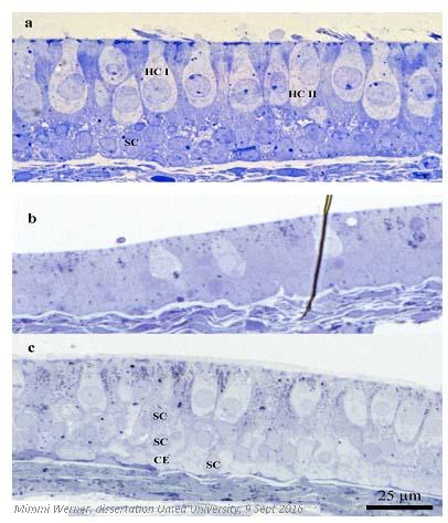 Balance Organ Hair Cells