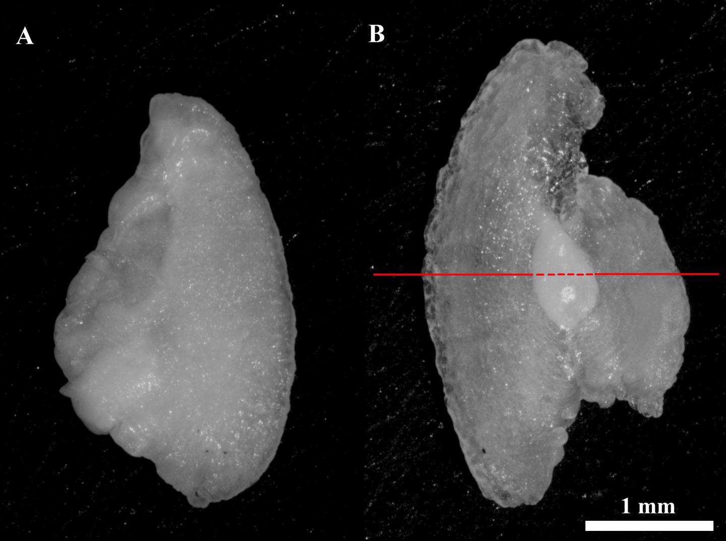 Sagittal Otoliths from a Juvenile Atlantic Salmon