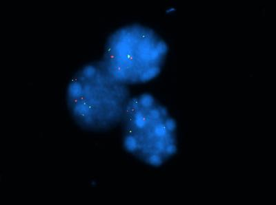 Visualizing the Number of Copies of ATG5 in Melanoma Cells