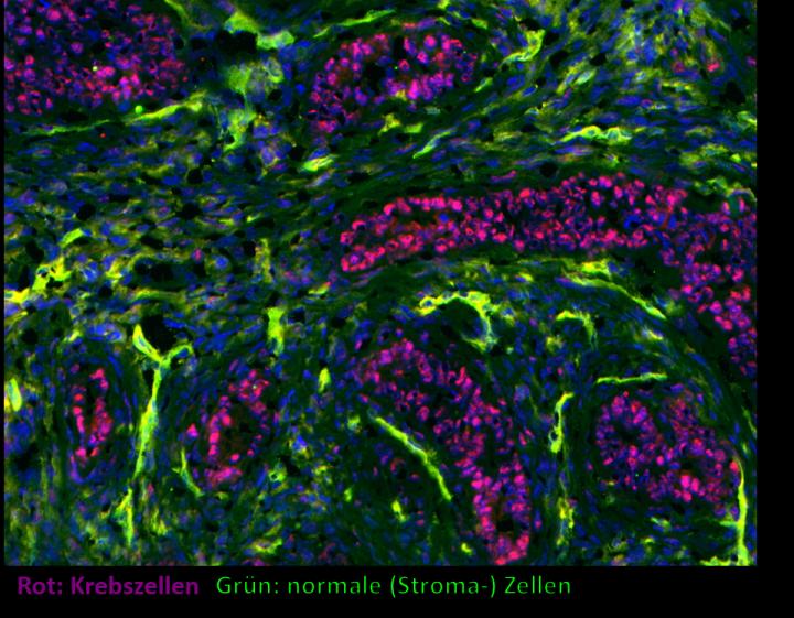 Cancer Cells