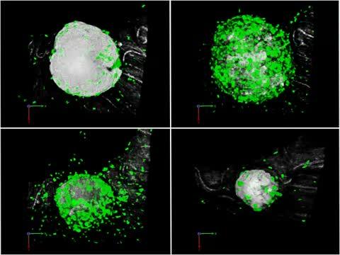 <em>In vivo</em> Imaging of Type 1 Diabetes Immunopathology Using Eye-Transplanted Islets (2 of 2)