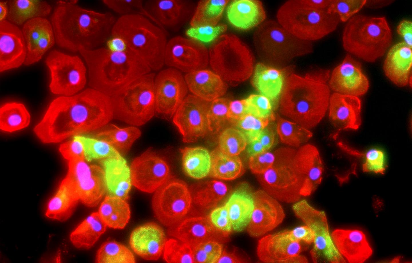 Macrophages