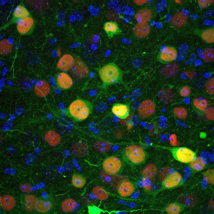 A key group of cerebral amygdala neurons identified in anxiety and social disorders
