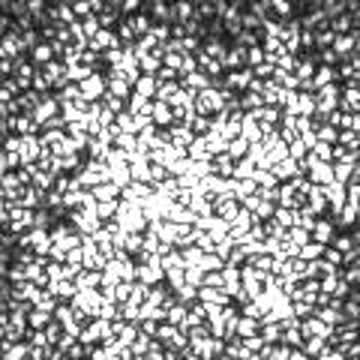 Speckle Pattern in Unclotted Whole Blood
