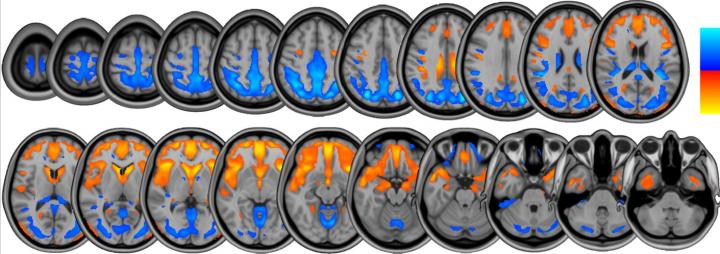 Neuromapping
