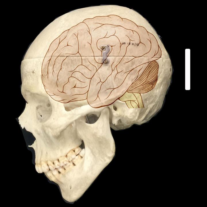 Human Brain Size