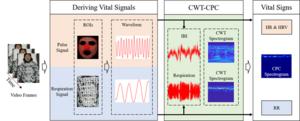 Principle of Video-Based Cardiopulmonary Coupling Monitoring